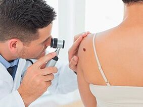 the doctor examines the papilloma and recommends removal with medication